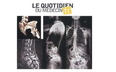 Une imprimante 3d pour la chirurgie