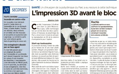 L’impression 3D : un plus pour la chirurgie